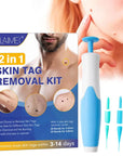 Skin Tag Remover Kit