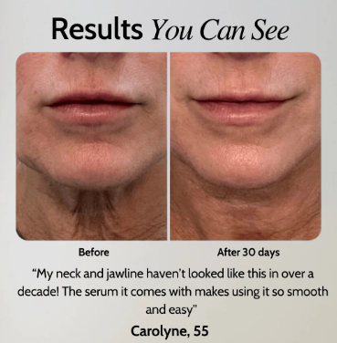 EMS Facial Toner Gel and Device